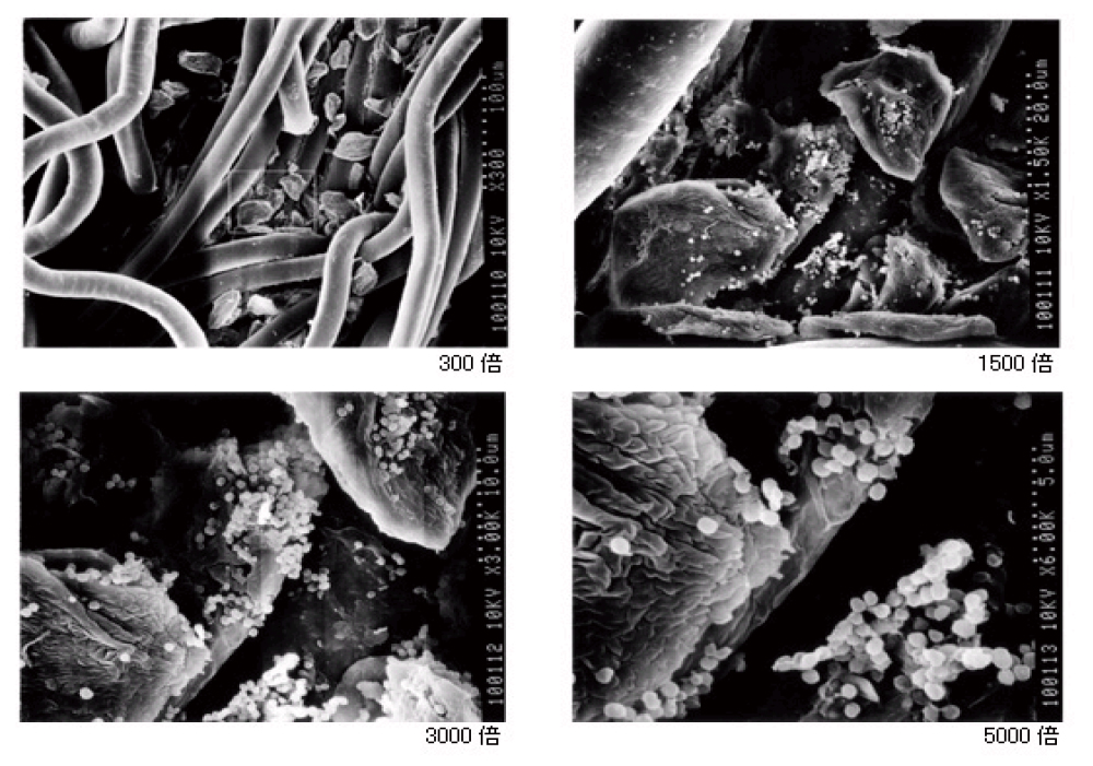 ブーツ　臭い　雑菌を顕微鏡で確認