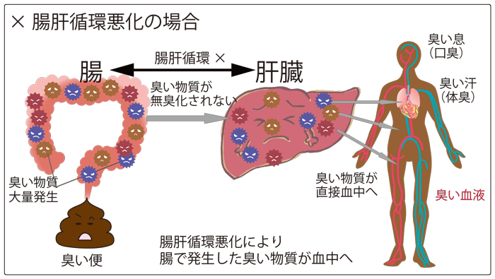 悪化した腸肝循環